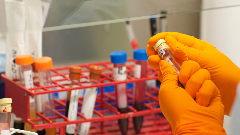 无需活检!新型血液检测可精准识别乳腺癌类型,让治疗更快更准!