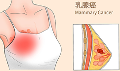 7.3个月升至15个月：乳腺癌前沿三联疗法让晚期患者肿瘤控制时间翻倍！