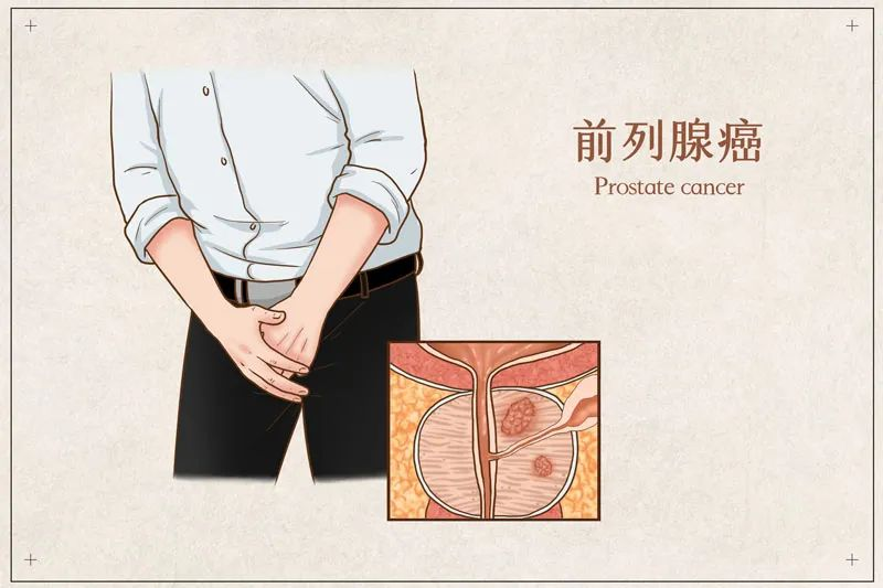 开云下载非常快
去美国安德森肿瘤医院治疗有何优势？