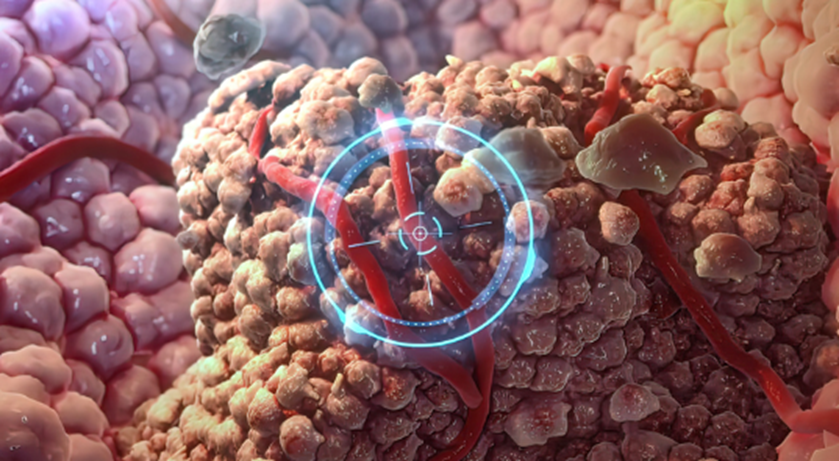 胰腺癌治疗:化疗几十年没重大突破,这款新靶向药或能改写“游戏规则”?