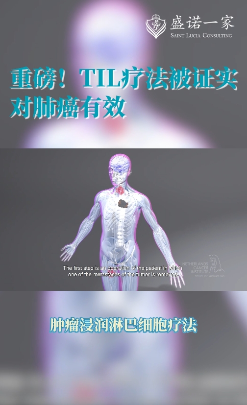 海外新药新技术：肺癌TIL疗法被证实有效