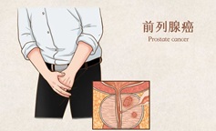 开云下载非常快
不用怕了？前沿机器人无创手术在门诊1小时搞定，做完当天回家！